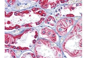 Immunohistochemical analysis of paraffin-embedded human Kidney tissues using CK8 mouse mAb (KRT8 antibody)