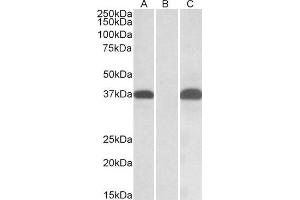 HEK293 lysate (10ug protein in RIPA buffer) overexpressing Human PIM2 with C-terminal MYC tag probed with ABIN1590033 (0. (PIM2 antibody  (AA 23-36))