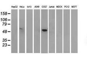 Image no. 2 for anti-Tumor Protein P53 (TP53) antibody (ABIN1499976) (p53 antibody)