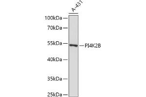 Western blot analysis of extracts of A-431 cells, using PI4K2B antibody (ABIN7269285) at 1:1000 dilution. (PI4K2B antibody  (AA 1-120))