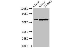 Western Blot Positive WB detected in: Rat liver tissue, Mouse liver tissue, Mouse kidney tissue All lanes: ZNF695 antibody at 3.