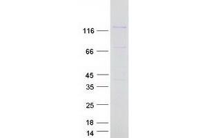 Western Blotting (WB) image for Protein Phosphatase 6, Regulatory Subunit 3 (PPP6R3) (Transcript Variant 4) protein (Myc-DYKDDDDK Tag) (ABIN2712364)