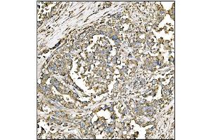 IHC analysis of HCCS using anti-HCCS antibody (ABIN7602424). (HCCS antibody  (AA 76-268))
