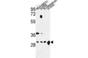 Western Blotting (WB) image for anti-14-3-3 zeta (YWHAZ) antibody (ABIN5024052)