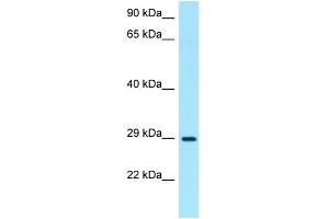 WB Suggested Anti-TNIP3 Antibody Titration: 1. (TNIP3 antibody  (N-Term))