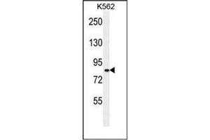 Western blot analysis of Whirlin  Antibody  in K562 cell line lysates (35ug/lane). (DFNB31 antibody  (Middle Region))