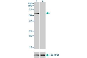 Western blot analysis of CESK1 over-expressed 293 cell line, cotransfected with CESK1 Validated Chimera RNAi (Lane 2) or non-transfected control (Lane 1). (CCT8L2 antibody  (AA 1-557))