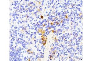 IHC analysis of TRAP/CD40L/Cd40lg using anti-TRAP/CD40L/Cd40lg antibody (ABIN7599747). (CD40 Ligand antibody  (AA 112-260))