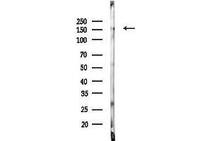 anti-Nephronophthisis 3 (Adolescent) (NPHP3) (C-Term) antibody