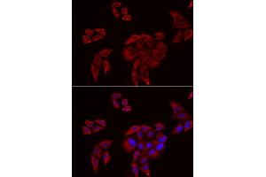 Immunofluorescence analysis of U2OS cells using P2RX4 antibody (ABIN5974027).