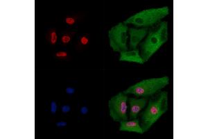 ABIN6261828 and ABIN6274011 staining  cells by IF/ICC.