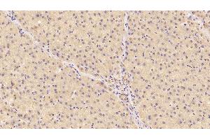 Immunohistochemistry (IHC) image for anti-Cerebral Dopamine Neurotrophic Factor (CDNF) (AA 33-187) antibody (ABIN7427180)