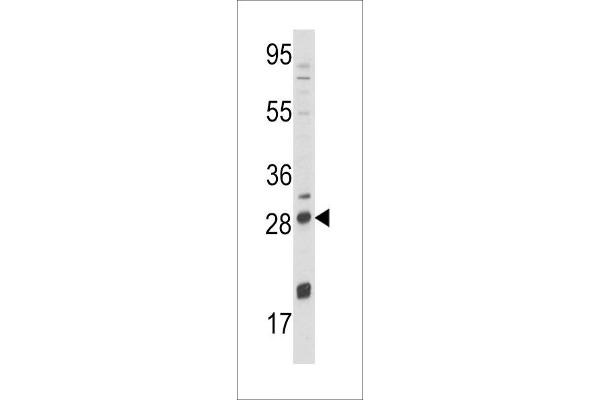NGFB Antikörper  (AA 84-115)