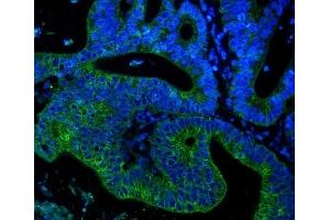 IF analysis of Cytokeratin 18 using anti-Cytokeratin 18 antibody (ABIN7600573). (Cytokeratin 18 antibody  (AA 204-430))