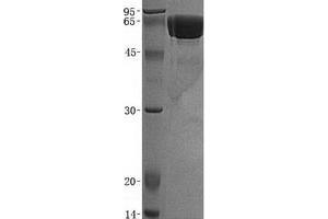 Validation with Western Blot (CNDP1 Protein (His tag))
