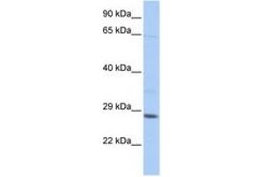 Image no. 1 for anti-TGFB-Induced Factor Homeobox 2-Like, X-Linked (TGIF2LX) (C-Term) antibody (ABIN6742653) (TGIF2LX antibody  (C-Term))