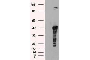 Image no. 1 for anti-Glial Fibrillary Acidic Protein (GFAP) antibody (ABIN1498438) (GFAP antibody)