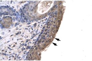 Human Spermatophore (RLIM antibody  (C-Term))