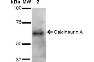 Western blot analysis of Rat Brain cell lysates showing detection of ~61 kDa Calcineurin A protein using Rabbit Anti-Calcineurin A Polyclonal Antibody . (Calcineurin A antibody  (AA 264-283) (FITC))