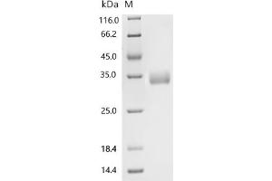 (Tris-Glycine gel) Discontinuous SDS-PAGE (reduced) with 5 % enrichment gel and 15 % separation gel.