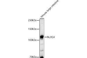 Western blot analysis of extracts of Mouse large intestine, using NLRC4 antibody (ABIN6129418, ABIN6144657, ABIN6144659 and ABIN6223243) at 1:1000 dilution. (NLRC4 antibody  (AA 1-250))
