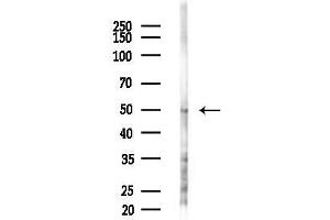 anti-Solute Carrier Family 18 (Vesicular Monoamine Transporter), Member 1 (SLC18A1) (C-Term) antibody