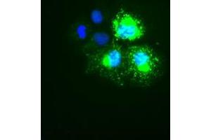Image no. 1 for anti-Keratin 18 (KRT18) (AA 69-372) antibody (ABIN1491638)