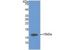 Detection of Recombinant VCL, Human using Polyclonal Antibody to Vinculin (VCL) (Vinculin antibody  (AA 1020-1134))