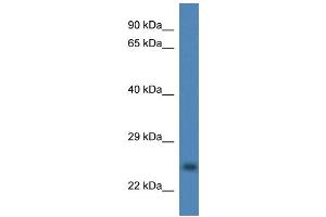 WB Suggested Anti-CCS Antibody Titration: 1. (Superoxide dismutase copper chaperone antibody  (Middle Region))