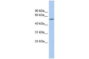 PRAME antibody used at 1 ug/ml to detect target protein. (PRAME antibody  (N-Term))