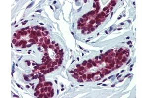 FUBP3 antibody was used for immunohistochemistry at a concentration of 4-8 ug/ml. (FUBP3 antibody  (Middle Region))
