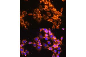 Immunofluorescence analysis of NIH-3T3 cells using  antibody  at dilution of 1:100. (ACAT1 antibody)