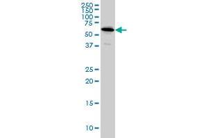 NDOR1 monoclonal antibody (M01), clone 3A11 Western Blot analysis of NDOR1 expression in HeLa . (NDOR1 antibody  (AA 498-595))