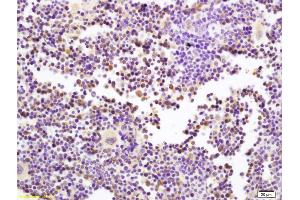 Formalin-fixed and paraffin embedded mouse spleen labeled with Anti-MDMX Polyclonal Antibody, Unconjugated (ABIN872900) at 1:200 followed by conjugation to the secondary antibody and DAB staining (MDM4-binding Protein antibody  (AA 301-400))