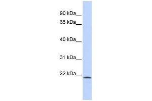 WB Suggested Anti-SCML1 Antibody Titration:  0.