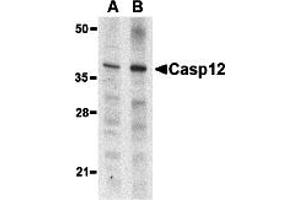 Western Blotting (WB) image for anti-Caspase 12 (Gene/pseudogene) (CASP12) (Small Isoform) antibody (ABIN1031700) (Caspase 12 antibody  (Small Isoform))