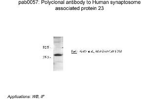 Image no. 2 for anti-Synaptosomal-Associated Protein, 23kDa (SNAP23) antibody (ABIN347010) (SNAP23 antibody)