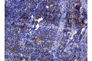 Immunohistochemistry (IHC) image for anti-Sterol O-Acyltransferase 2 (SOAT2) (AA 1-120) antibody (ABIN1490565) (SOAT2 antibody  (AA 1-120))