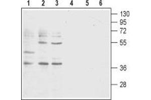 Western blot analysis of acute T-cell leukemia Jurkat (lanes 1 and 4), promyelocytic leukemia HL-60 (lanes 2 and 5) and acute monocytic leukemia THP-1 (lanes 3 and 6) human cell lysates: - 1-3.