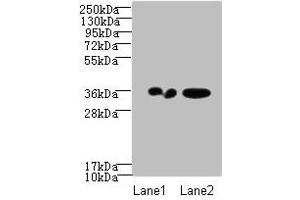 Western blot All lanes: RPRD1A antibody at 2 μg/mL Lane 1: A431 whole cell lysate Lane 2: Jurkat whole cell lysate Secondary Goat polyclonal to Rabbit IgG at 1/10000 dilution Predicted band size: 36, 32 kDa Observed band size: 36 kDa (RPRD1A antibody  (AA 2-276))