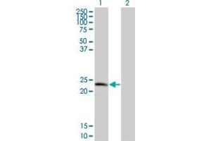 Western Blot analysis of TPD52 expression in transfected 293T cell line by TPD52 monoclonal antibody (M01), clone 1B6. (TPD52 antibody  (AA 100-184))