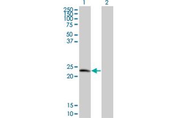 TPD52 Antikörper  (AA 100-184)