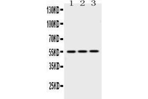Western blot analysis of Caspase8 using anti-Caspase8 antibody . (Caspase 8 antibody  (N-Term))