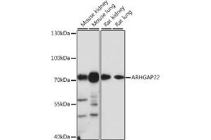 Western blot analysis of extracts of various cell lines, using  antibody (ABIN7269964) at 1:1000 dilution. (ARHGAP22 antibody  (AA 510-650))