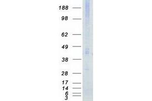 Validation with Western Blot