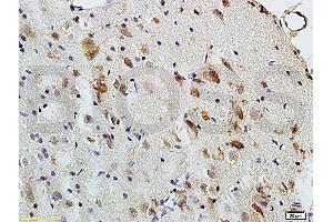 Formalin-fixed and paraffin embedded: rat brain tissue labeled with Anti-MBP Polyclonal Antibody (ABIN739400), Unconjugated at 1:200, followed by conjugation to the secondary antibody and DAB staining (MBP antibody  (AA 69-85))