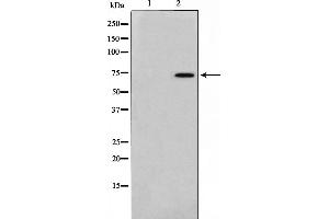 Western blot analysis of FKHR phosphorylation expression in HeLa whole cell lysates,The lane on the left is treated with the antigen-specific peptide. (FOXO1 antibody  (pSer256))