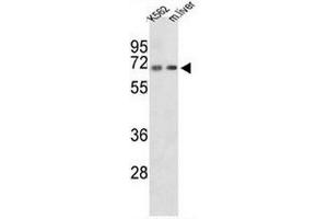 Western blot analysis of CROT Antibody (N-term) in K562 cell line and mouse liver tissue lysates (35µg/lane). (CROT antibody  (N-Term))