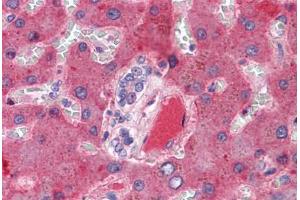 Liver, vessel: Formalin-Fixed, Paraffin-Embedded (FFPE) (Coagulation Factor X antibody)