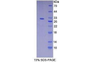 SDS-PAGE analysis of Human Nicastrin Protein. (Nicastrin Protein (NCSTN))
